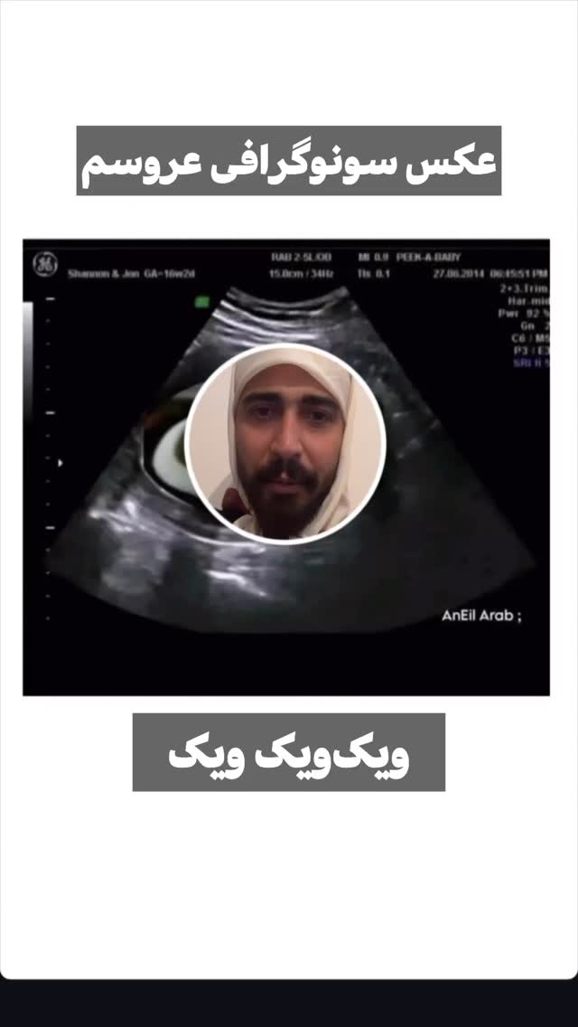  جدید ترین استوری اینستاگرام بهنام حیدری
