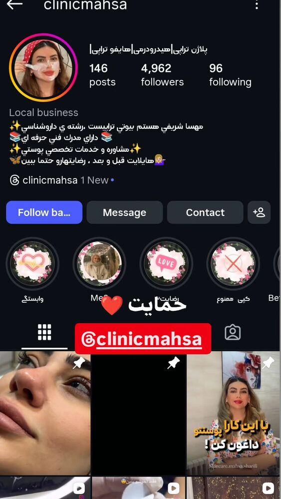  جدید ترین استوری اینستاگرام بهزاد محمدی