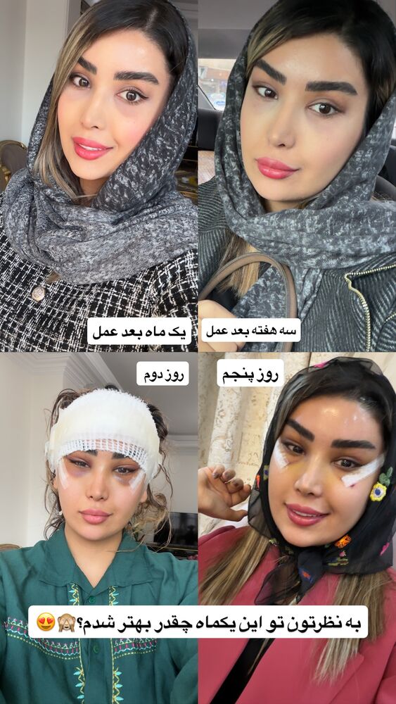  جدید ترین استوری اینستاگرام سرور مادر سلین (خانواده سلین)