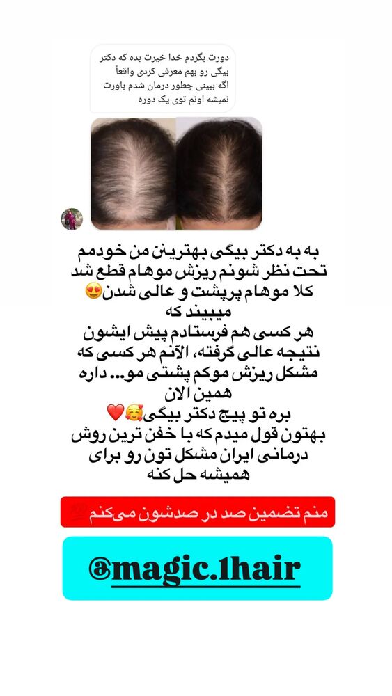  جدید ترین استوری اینستاگرام الهه خانم
