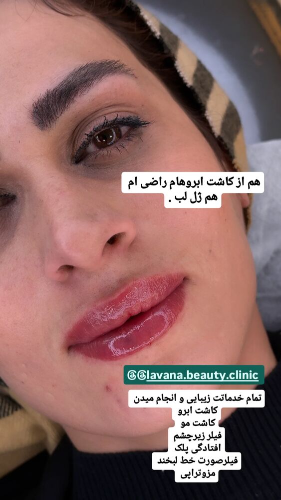  جدید ترین استوری اینستاگرام الهه خانم