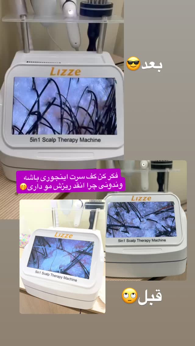  جدید ترین استوری اینستاگرام فاطیما