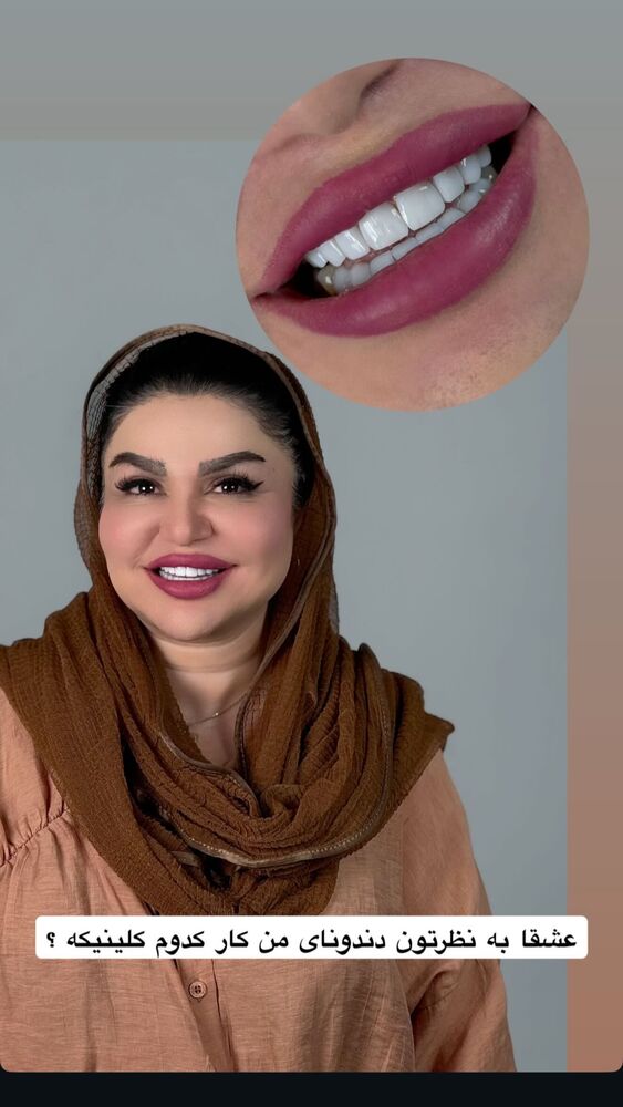  جدید ترین استوری اینستاگرام دلارام قشلاقي