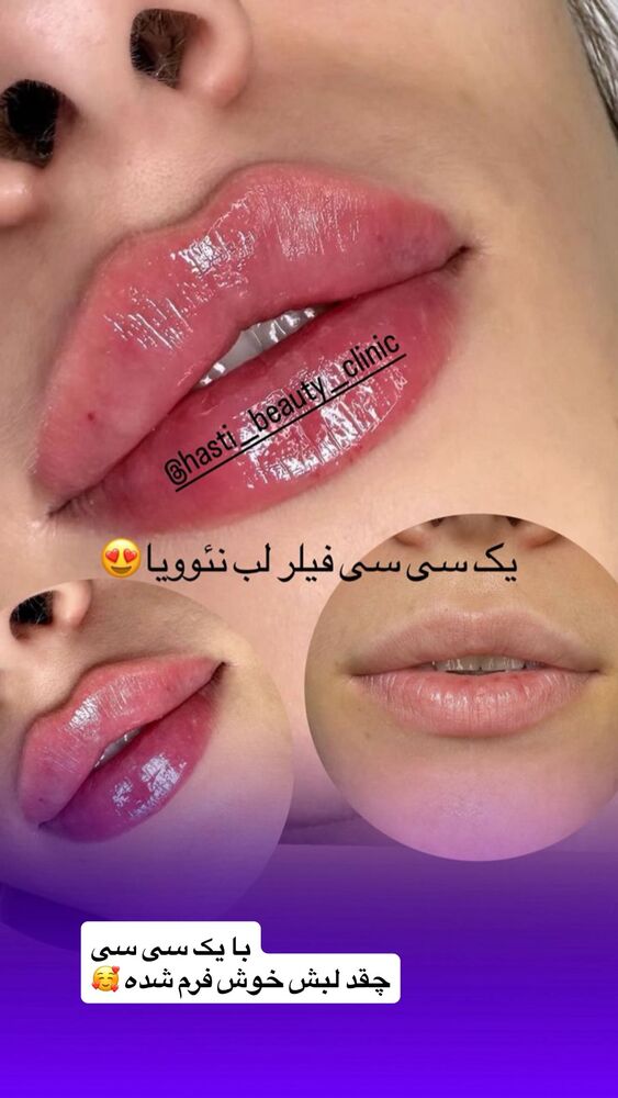  جدید ترین استوری اینستاگرام دلارام قشلاقي