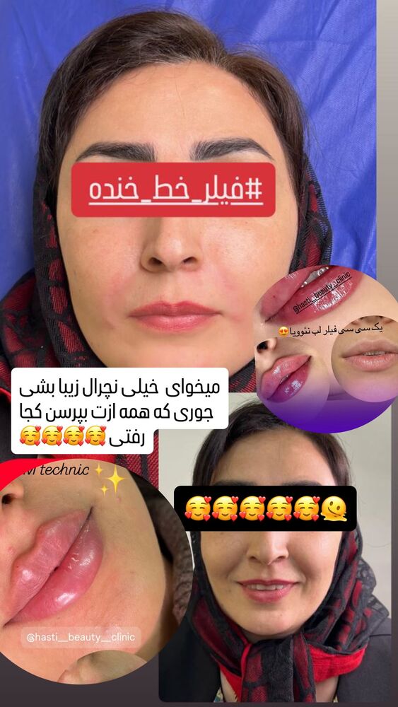  جدید ترین استوری اینستاگرام دلارام قشلاقي