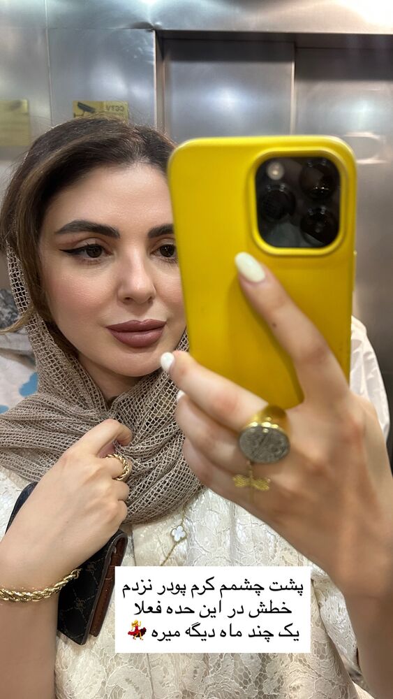  جدید ترین استوری اینستاگرام دنیز