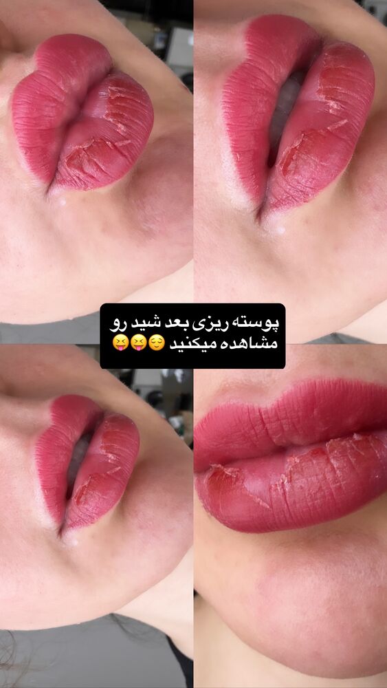  جدید ترین استوری اینستاگرام دنیز