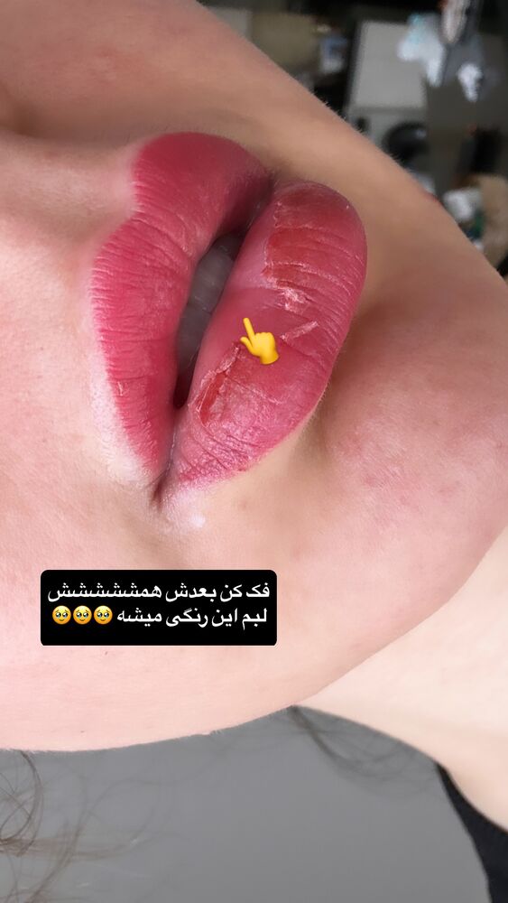  جدید ترین استوری اینستاگرام دنیز