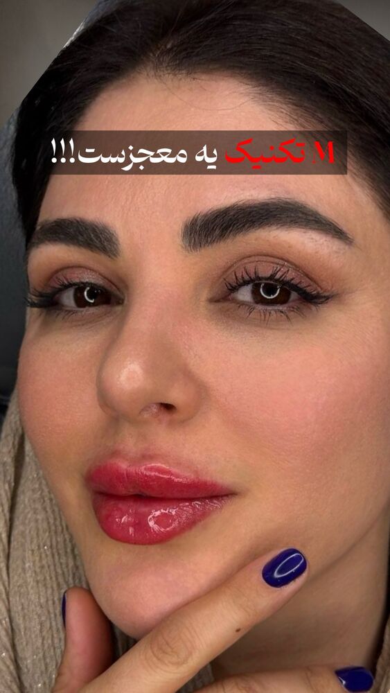  جدید ترین استوری اینستاگرام دنیز