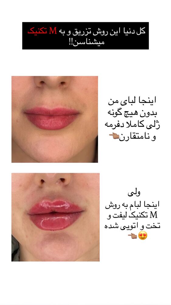  جدید ترین استوری اینستاگرام دنیز