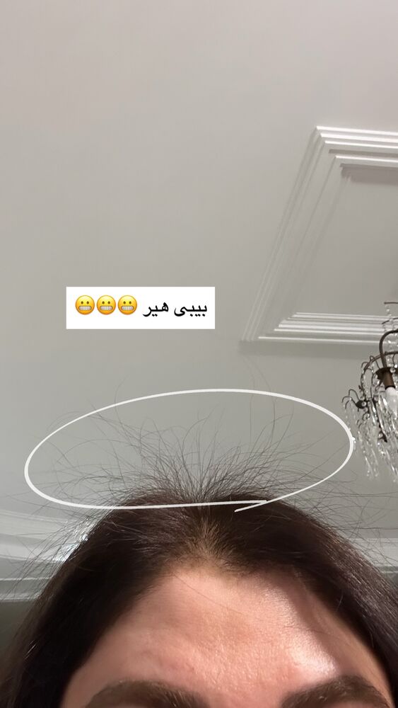  جدید ترین استوری اینستاگرام دنیز