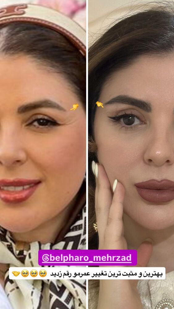  جدید ترین استوری اینستاگرام دنیز