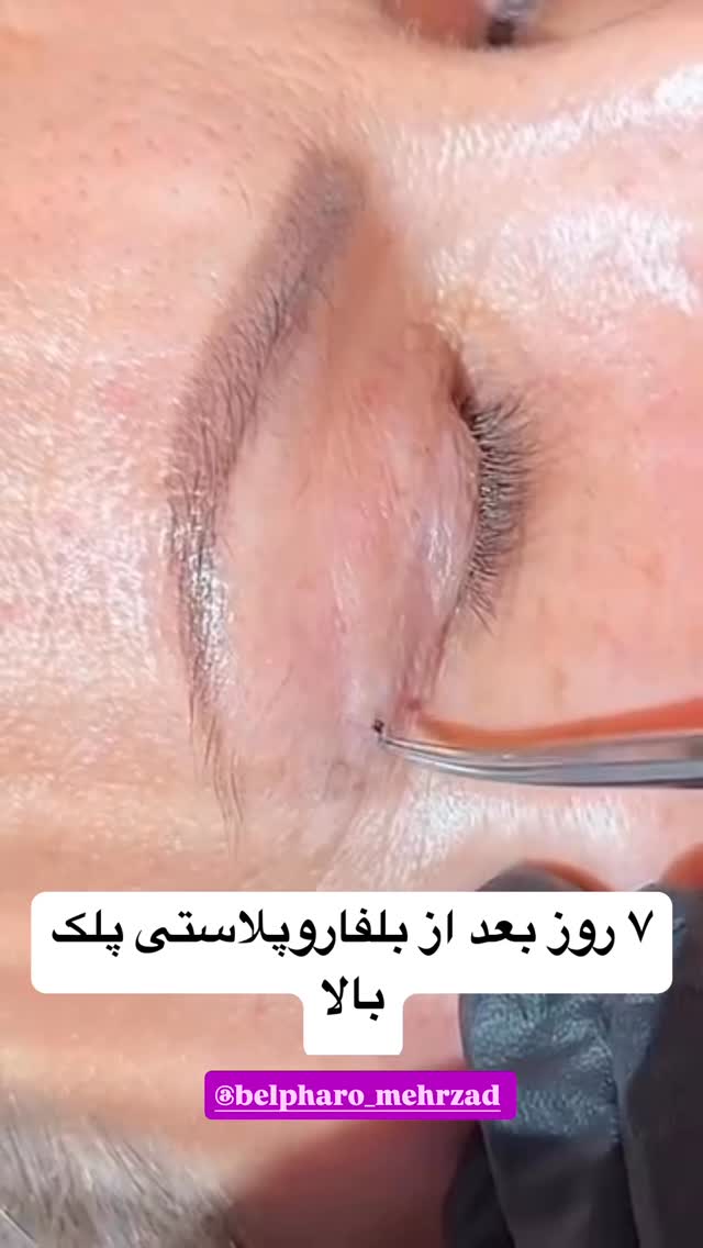  جدید ترین استوری اینستاگرام دنیز