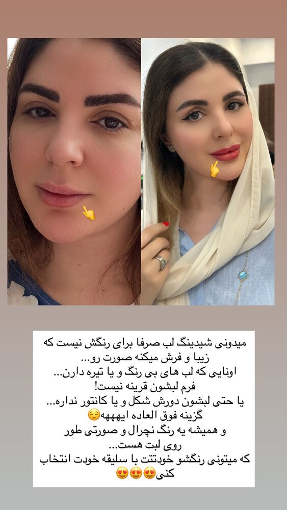  جدید ترین استوری اینستاگرام دنیز