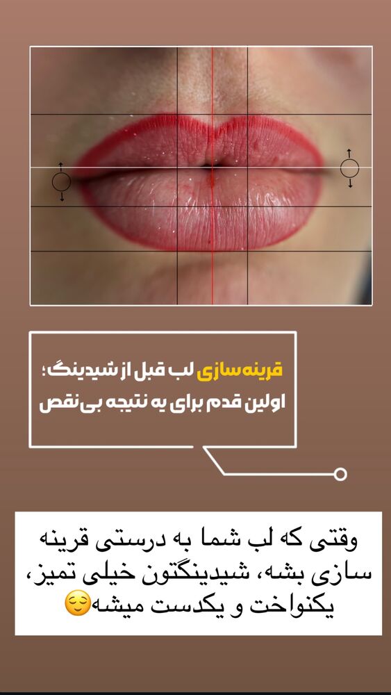 جدید ترین استوری اینستاگرام دنیز