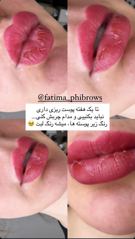  جدید ترین استوری اینستاگرام دنیز