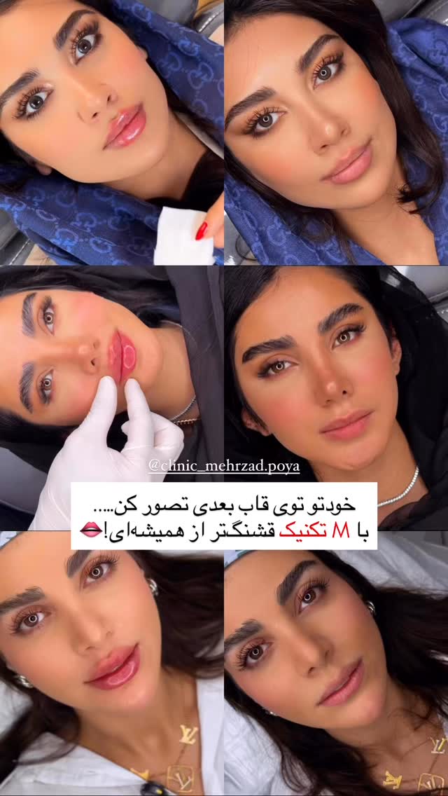  جدید ترین استوری اینستاگرام دنیز