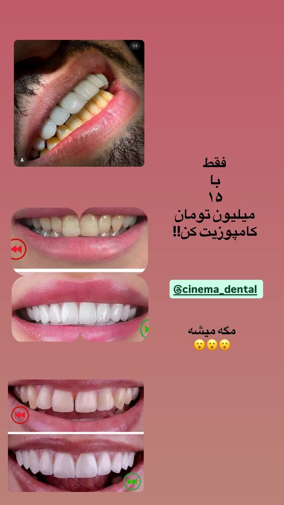  جدید ترین استوری اینستاگرام دنیز