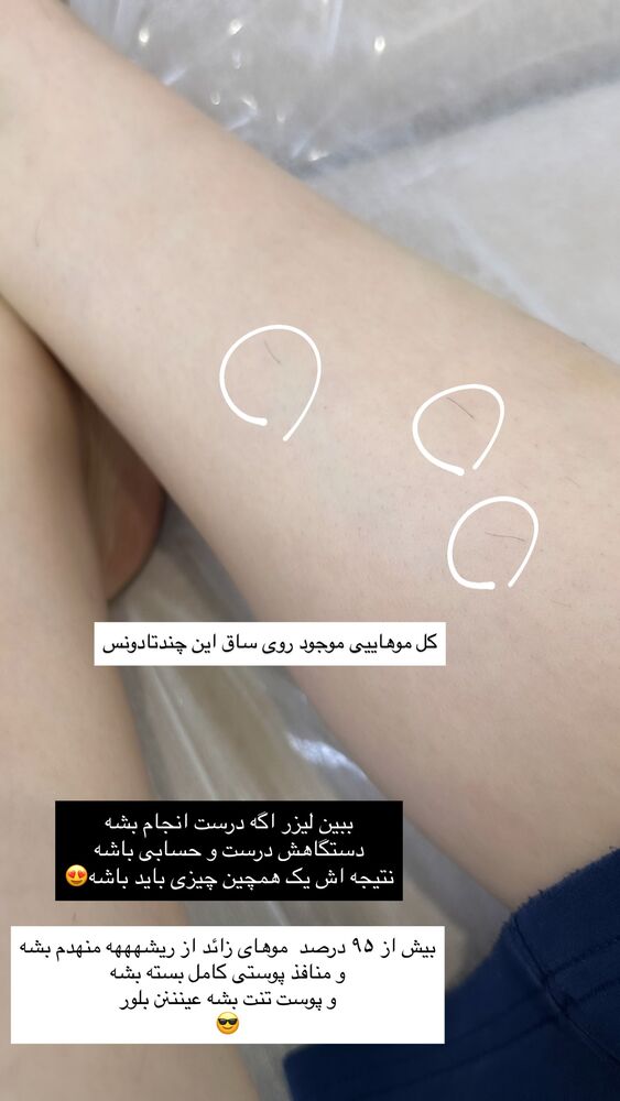  جدید ترین استوری اینستاگرام دنیز