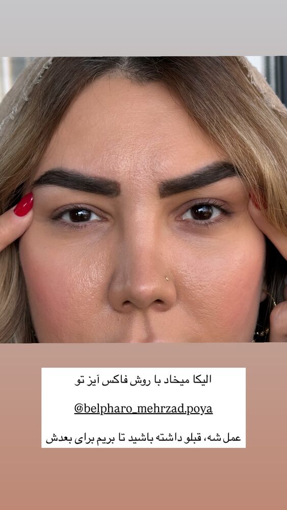  جدید ترین استوری اینستاگرام دنیز