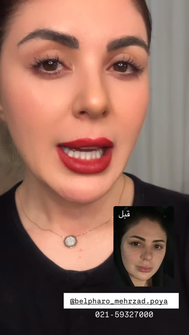 جدید ترین استوری اینستاگرام دنیز