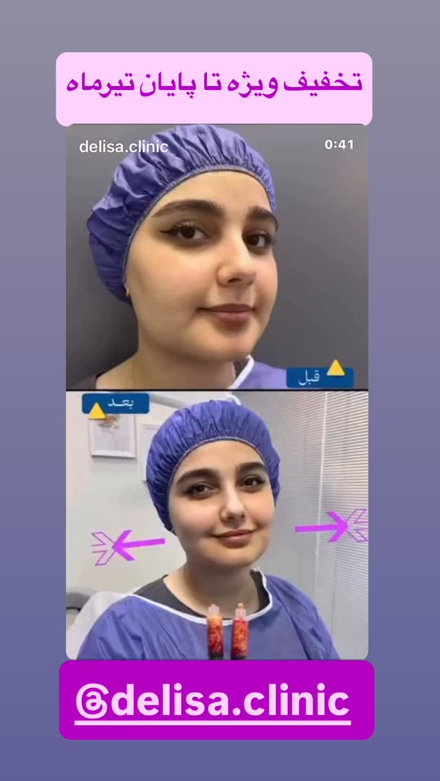  جدید ترین استوری اینستاگرام دیگچه