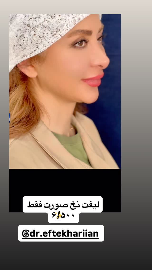  جدید ترین استوری اینستاگرام دیگچه