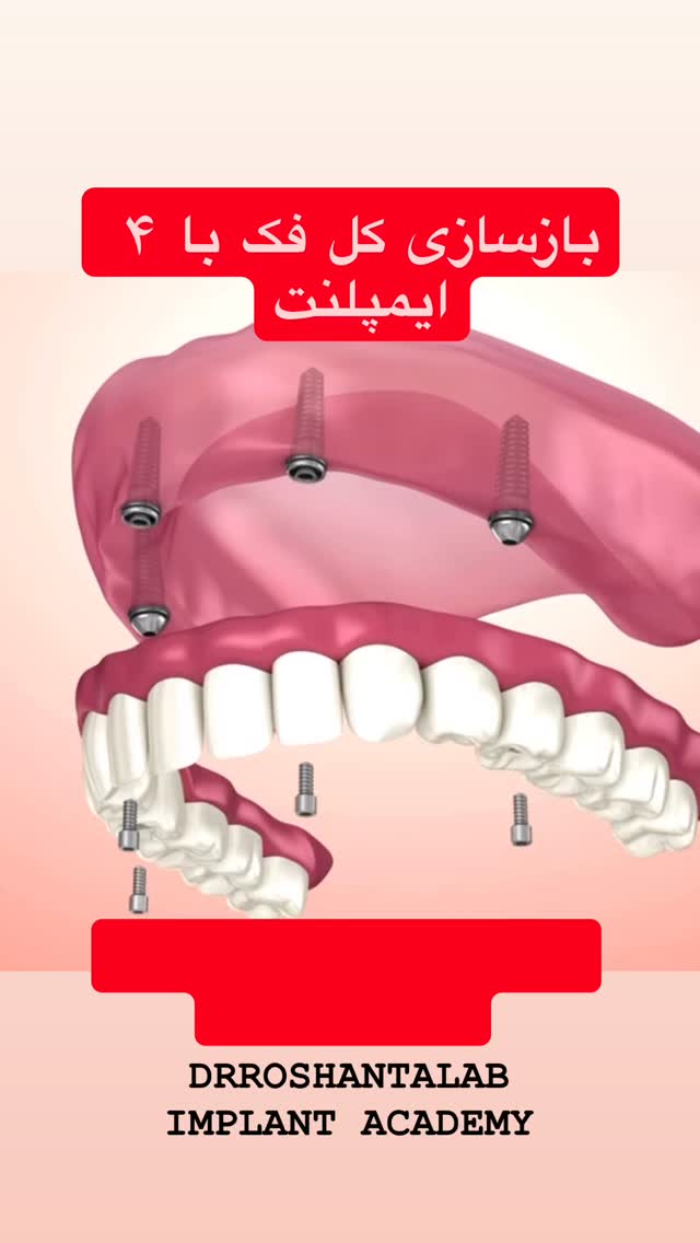  جدید ترین استوری اینستاگرام حسن روشن طلب
