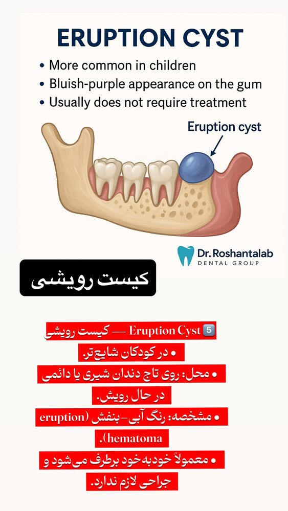  جدید ترین استوری اینستاگرام حسن روشن طلب