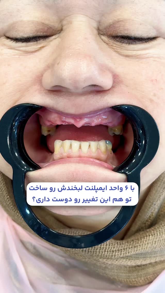  جدید ترین استوری اینستاگرام حسن روشن طلب