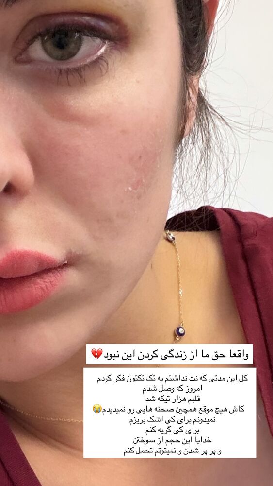  جدید ترین استوری اینستاگرام سمیرا حکمت