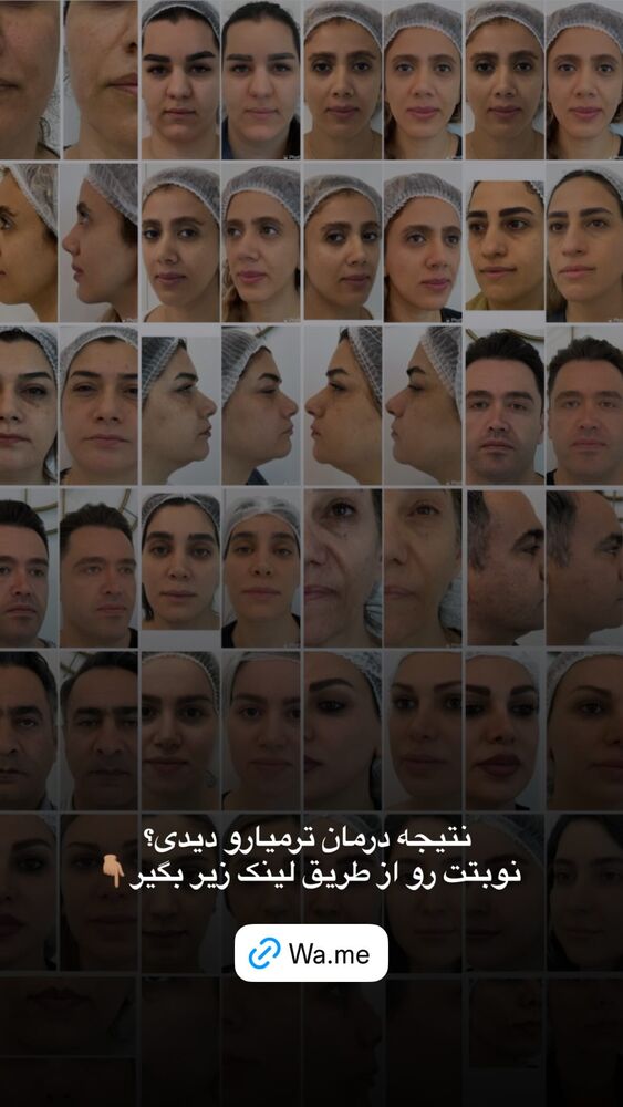  جدید ترین استوری اینستاگرام دکتر احراری