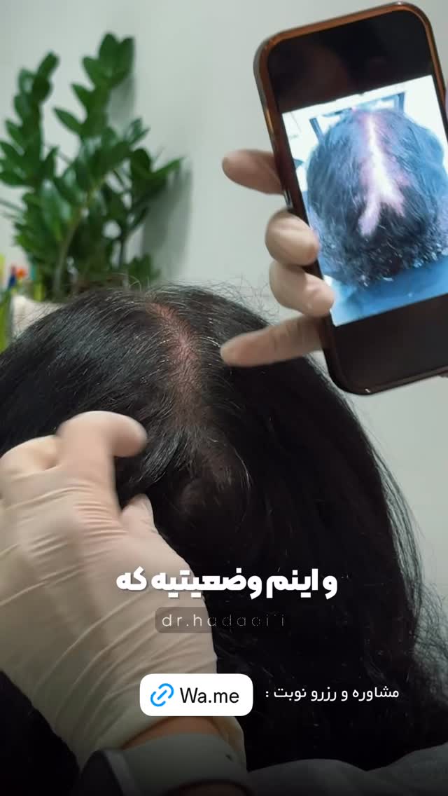  جدید ترین استوری اینستاگرام دکتر احراری