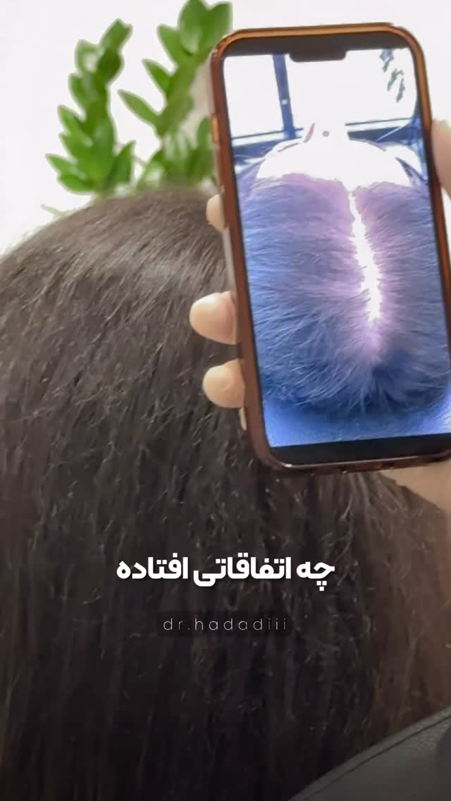  جدید ترین استوری اینستاگرام دکتر احراری