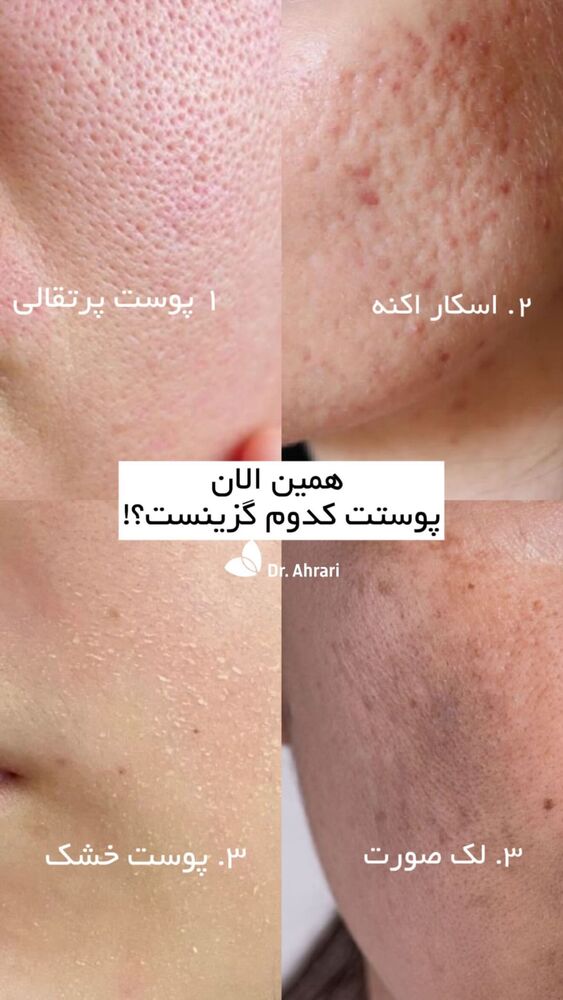  جدید ترین استوری اینستاگرام دکتر احراری