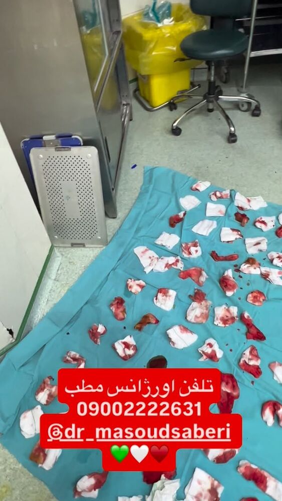  جدید ترین استوری اینستاگرام مسعود صابري