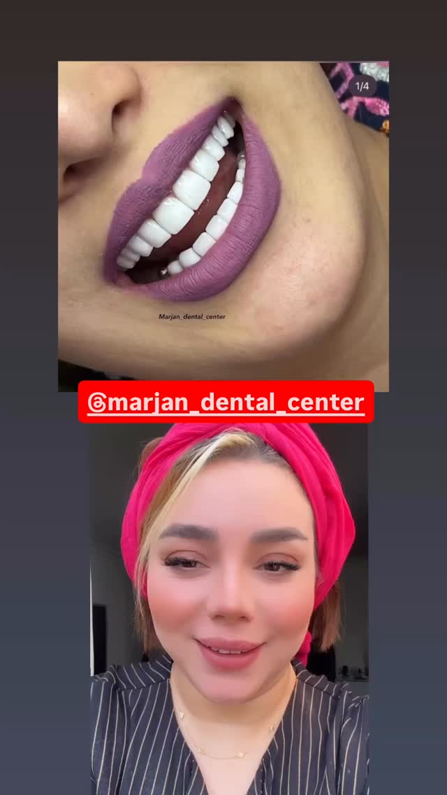  جدید ترین استوری اینستاگرام الهه برزگر