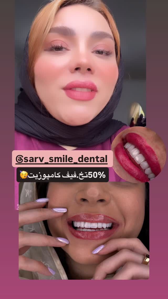  جدید ترین استوری اینستاگرام الهه برزگر