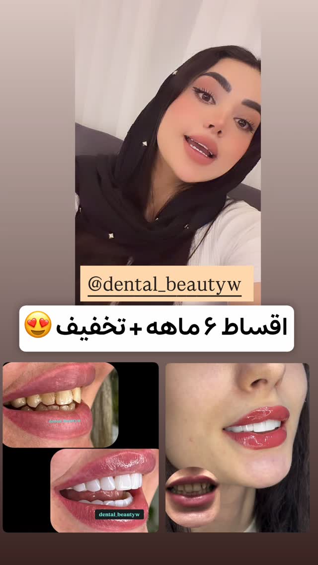  جدید ترین استوری اینستاگرام الهه نصرتی