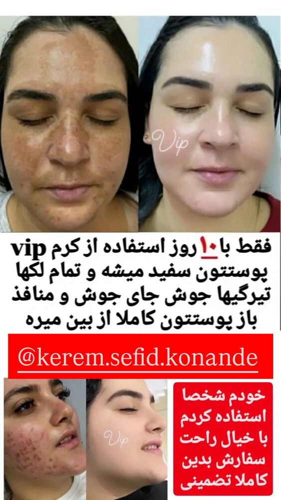  جدید ترین استوری اینستاگرام الهه نصرتی