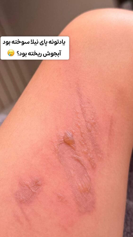  جدید ترین استوری اینستاگرام الهه نصرتی