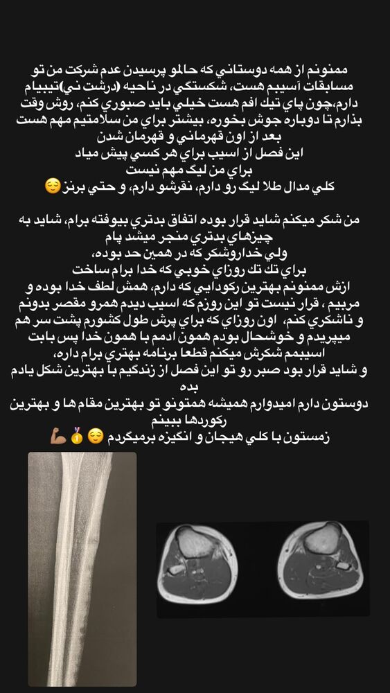  جدید ترین استوری اینستاگرام الهه رحیمی فر