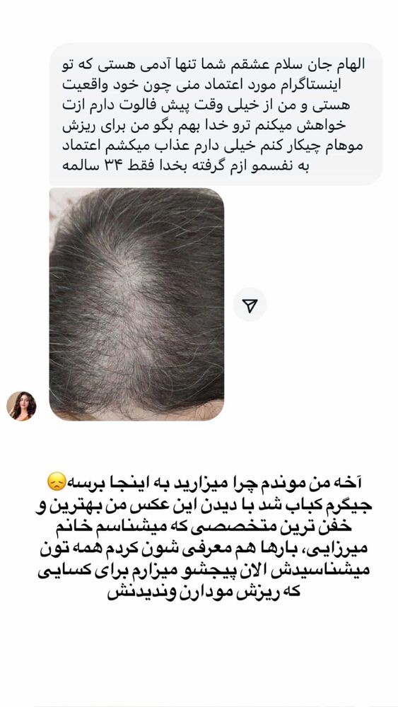  جدید ترین استوری اینستاگرام الهام طهماسبی