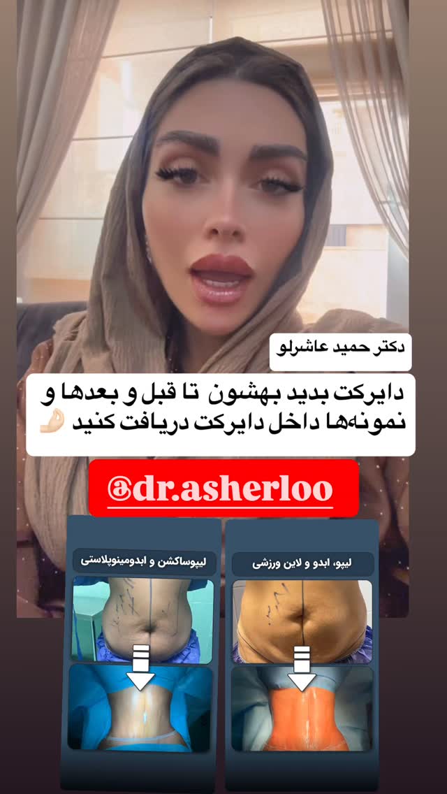  جدید ترین استوری اینستاگرام الهام طهماسبی