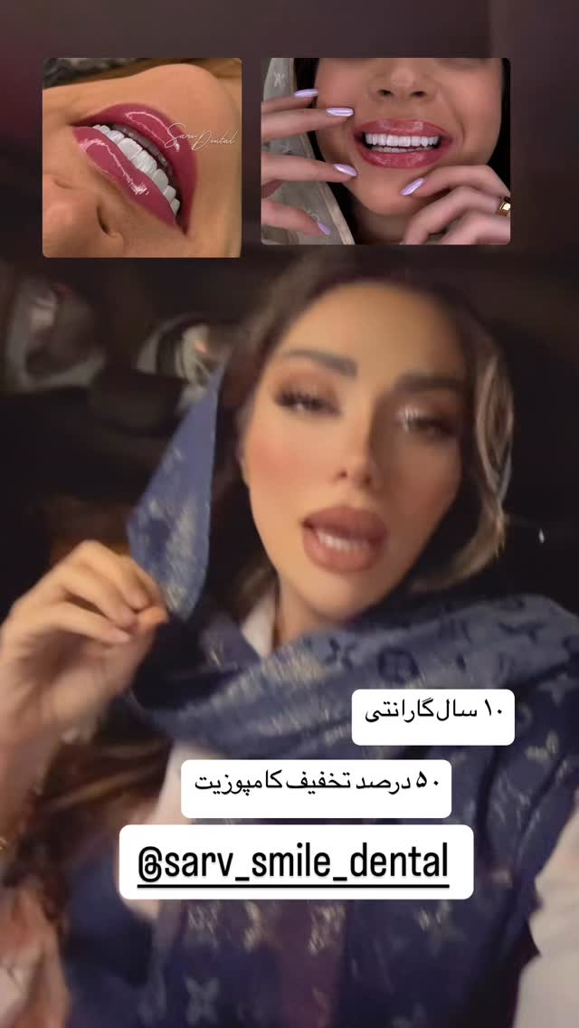  جدید ترین استوری اینستاگرام الهام طهماسبی