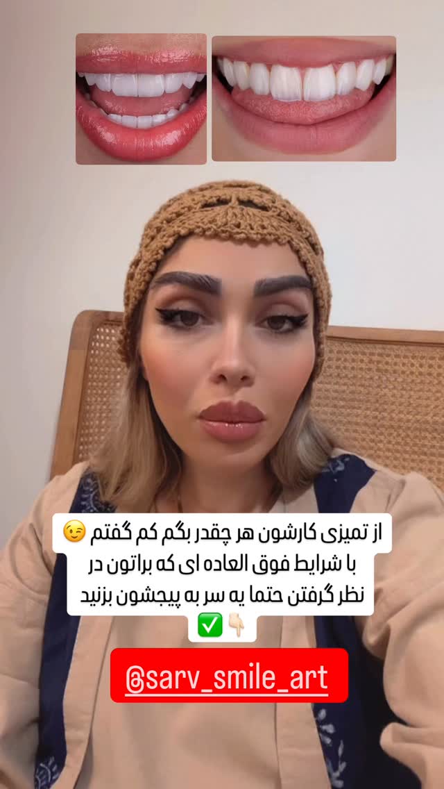  جدید ترین استوری اینستاگرام الهام طهماسبی