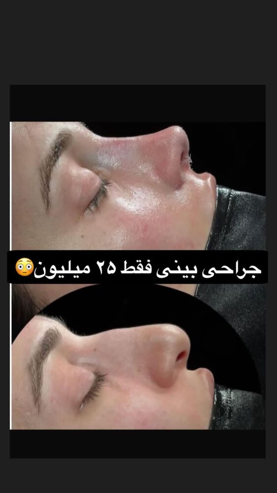  جدید ترین استوری اینستاگرام الهام طهماسبی