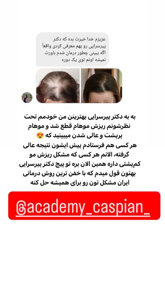  جدید ترین استوری اینستاگرام الهام طهماسبی