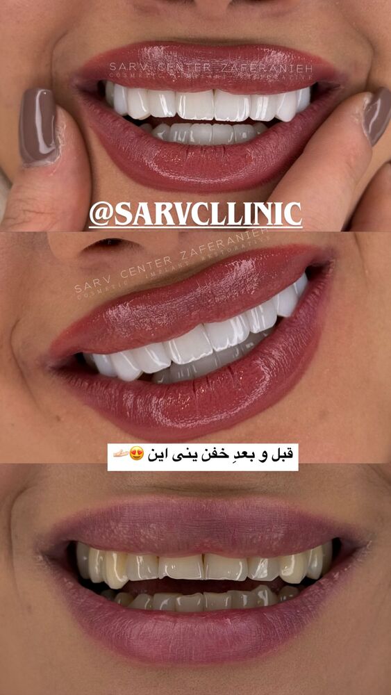  جدید ترین استوری اینستاگرام الهام طهماسبی
