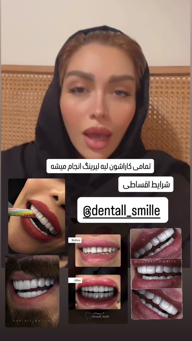  جدید ترین استوری اینستاگرام الهام طهماسبی
